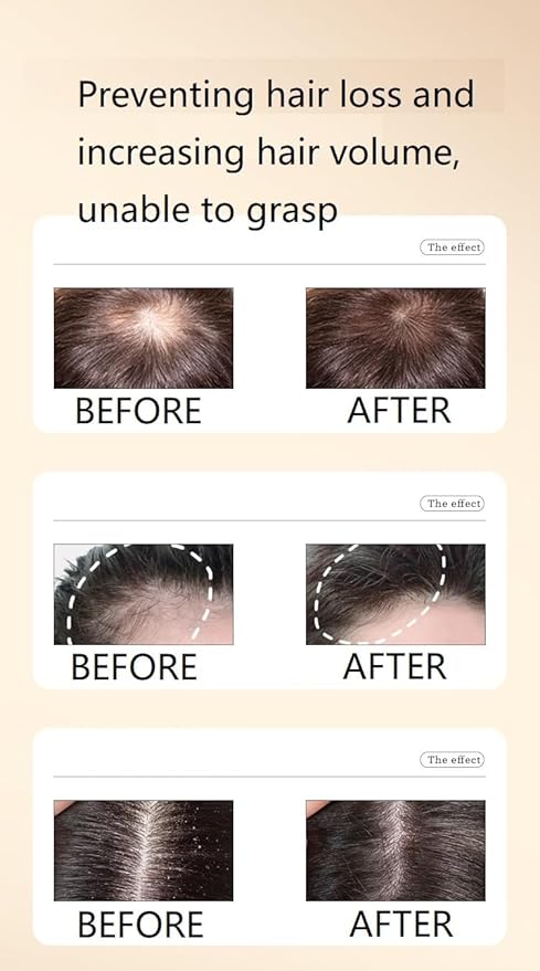 2 Box Ginger Plant Extract Shampoo for Hair Growth and Anti-Loss Control, Hair Growth Oil Care by Ginaday