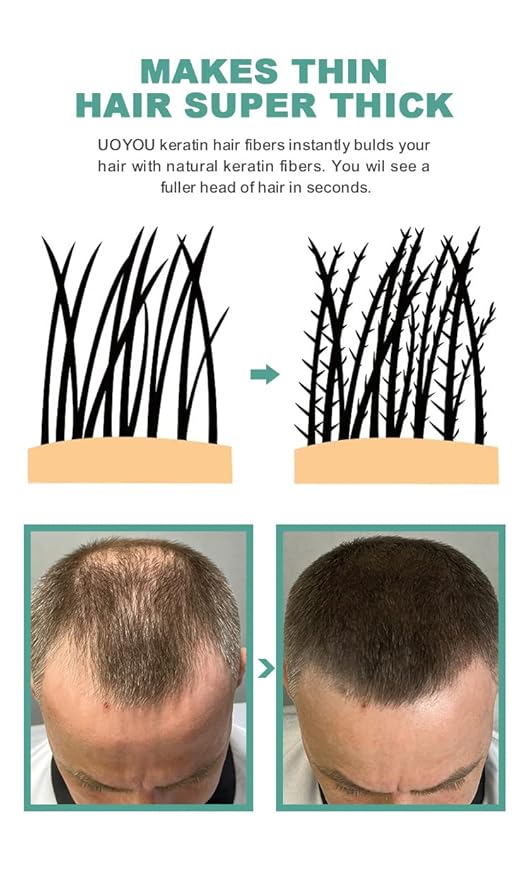 MEDIUM BROWN Hair Fibers for Thinning Hair 27.5g Bottle | Undetectable & Natural Keratin Hair Fibers Concealer for Hair Loss for Men and Women | Hair Building Fibres Powder [MEDIUM BROWN]