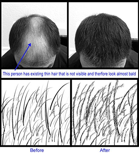for Thinning Hair - 100% Undetectable Natural Formula - Completely Conceals Hair Loss in Seconds. Covers bald spots. Thicken your hair instantly - 25 Grams Refill (WHITE)