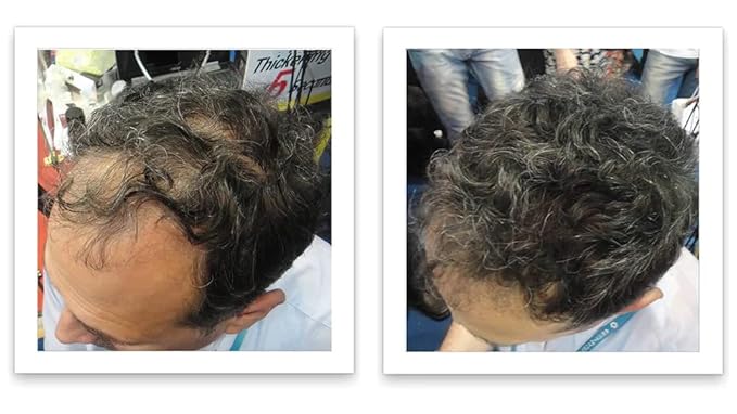 Caboki Hair Loss Concealer (All-Natural Hair Building Fibers) Travel Size. (Salt & Pepper - Dark)