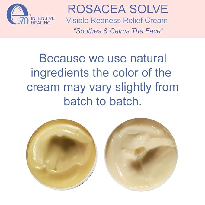Rosacea Treatment for Face Skincare Cream for Women & Men (Pack of 2) - Gentle Moisturizer Redness Reducing Skin Care - with Aloe Vera & Hyaluronic Acid - Day-Night, Made in USA by e70 (2.25 fl. oz.)