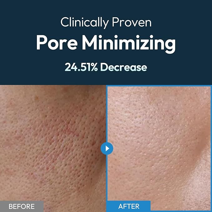 Men's Pore Minimizing Face Gel Moisturizer - 24H Hydrating & Soothing Oil Control Daily Facial Lotion, Lightweight & Non-Greasy for All Skin Types, 3.71 fl oz