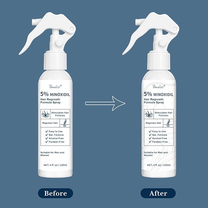 5% Minoxidil for Men and Women, Hair & Beard Growth Treatment with Biotin & Rosemary Growth Treatment for Thinning & Hair Loss - Extra Strength Minoxidil Hair Loss Serum 4 oz