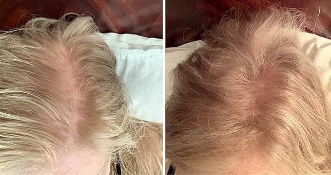 Caboki Hair Fibers for Thinning Hair – Natural Plant-Based Hair Powder for Men & Women – Instantly Thicker Fuller Looking Hair – Wind & Sweat Resistant – 30g, 90-Day Supply, Golden Blonde