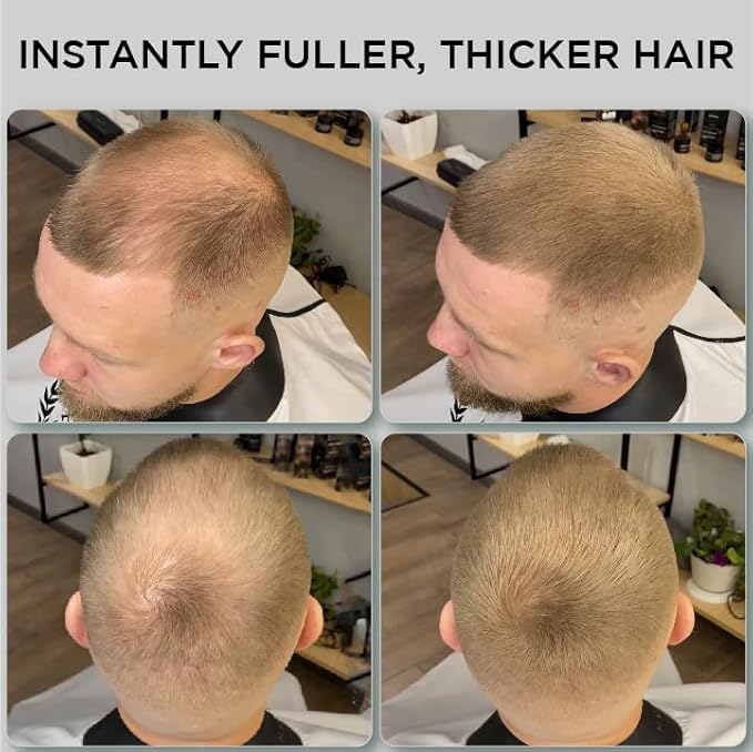 THICK FIBER Hair Fibers for Thinning Hair & Bald spots (LIGHT BROWN) - 25g Bottle - Conceals Hair Loss in Seconds - Hair Powder for Women & Men