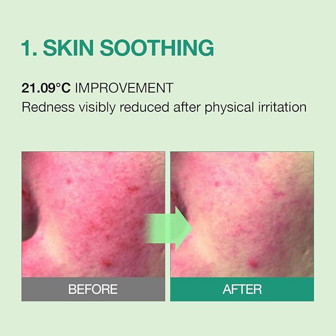 Tea Tree Soothing In Calming Cream for Sensitive Skin with Centella Asiatica help reduce redness and breakouts, Low irritating, Moisturizing Daily Texture Care, Korean Skin Care (2.70 fl.oz)