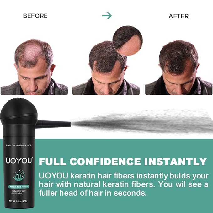 MEDIUM BROWN Hair Fibers for Thinning Hair 27.5g Bottle with Applicator | Natural Keratin Hair Fibers Concealer for Hair Loss for Men and Women | Hair Building Fibres Powder [MEDIUM BROWN Hair Fiber]