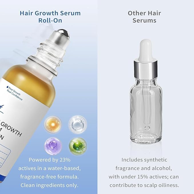 Hair Growth Serum Roll-On for Thinning Hair – Stimulates Follicles, Strengthens Roots & Boosts Density with Rosemary & Biotin – Non-Greasy Scalp Treatment for Men and Women 30ml