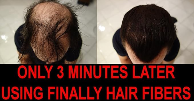 Hair Building Fibers 25 Grams .88 oz Refill Your Existing Bottle. Highest Grade Fiber by Finally Hair (Pure White)