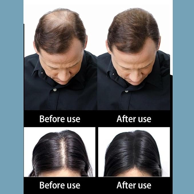 hair growth for men，For Hair Loss & Thinning Hair，30ml