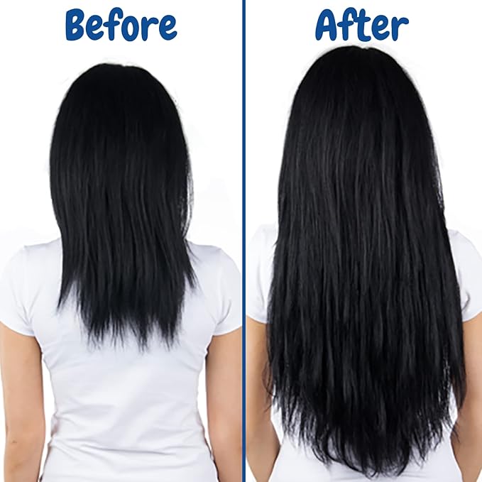 Verseo Sup Hair Growth Conditioner Treatment | Conditioner for Thinning Hair and Hair Loss | Repairing Damaged Hair | 28 Day Supply