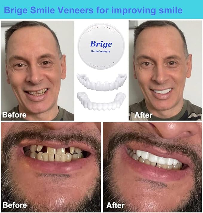 Brige Smile Teeth Denture Temporary False Teeth Improve Smile