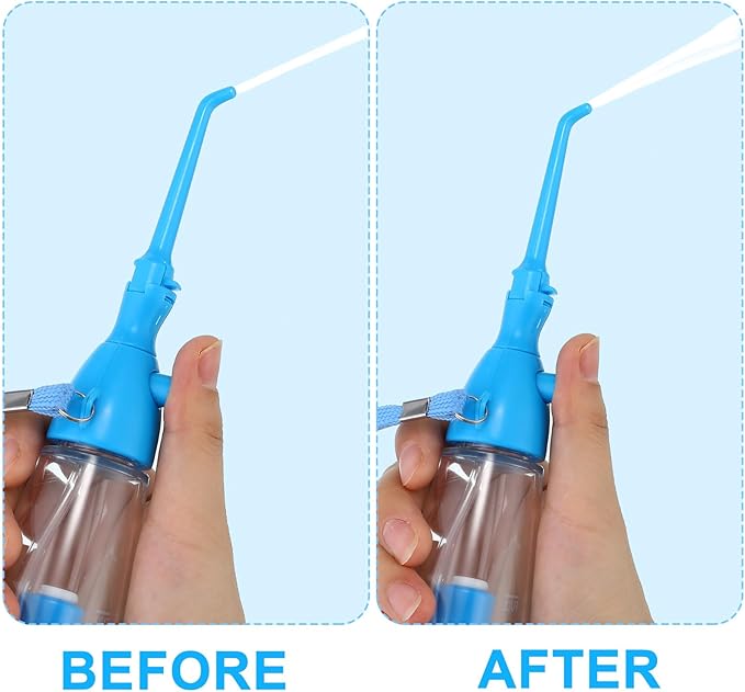 Water Dental Flosser for Teeth Oral Irrigator Water Teeth Cleaner Non Electric Portable Affordable Oral Irrigator Cordless Manual Air Pressure Simple Operation for Home and Travel