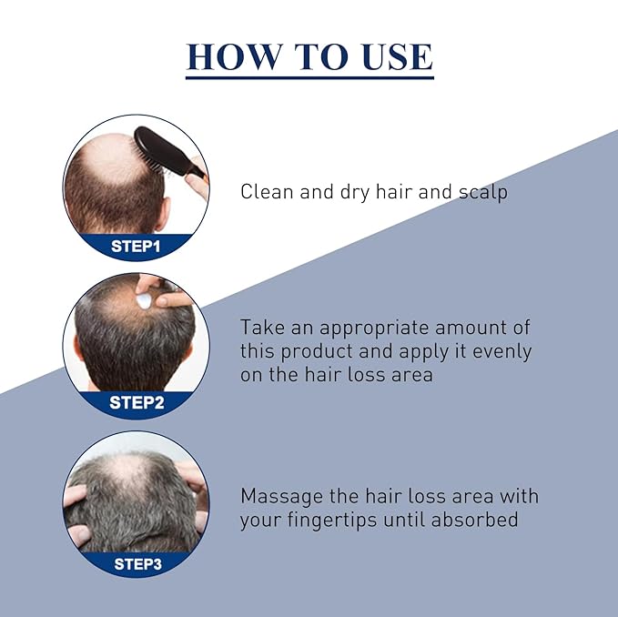 20g Hair Growth Cream for Thinning Hair – Stimulates Follicles, Reduces Hair Loss & Boosts Regrowth for Men and Women – Natural Scalp Treatment for Bald Spots & Receding Hairline