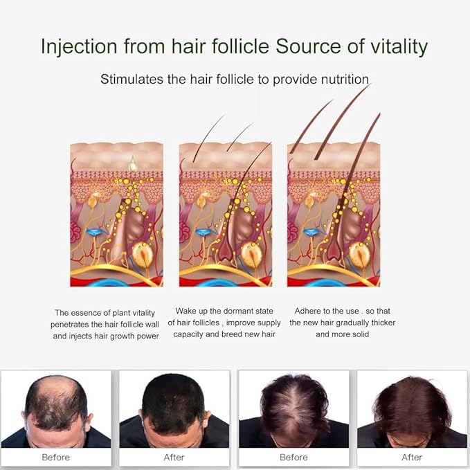 2PCS Hair Growth Spray for Anti Hair Loss Fast Treatment Scalp Prevent Hair Thinning Dry Frizzy Conditioning Strong Hair Root