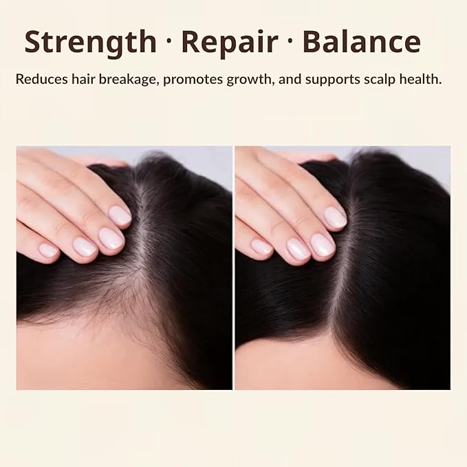 Onion & Biotin Hair Growth Shampoo – Concentrated Formula for Thicker, Fuller-Looking Hair – With Rosemary Extract – Hydrates, Strengthens & Reduces Breakage – Sulfate-Free for All Hair Typess