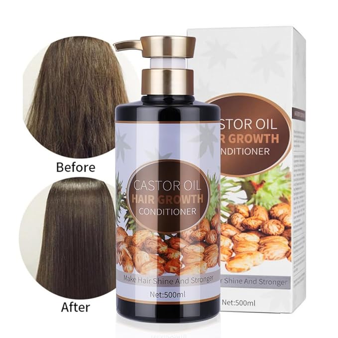 Silvercell Castor Oil Conditioner Hair Growth Conditioner Moisturizing Oil Control, Thickening Hair Conditioner for Damaged Dry Hair, 16.91 fl.oz