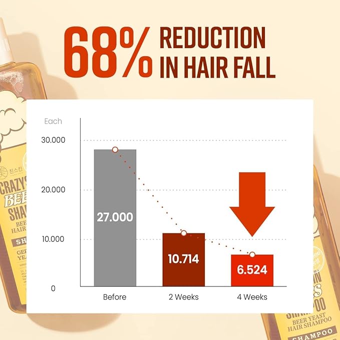 CRAZY SKIN German Beers Yeast Biotin Shampoo for Anti-hair loss, and Thickening,Gentle Exfoliating & Scalp Function with Panthenol, Collagen and Free-Sulfate, limescale removal, 300ml(10.15oz)