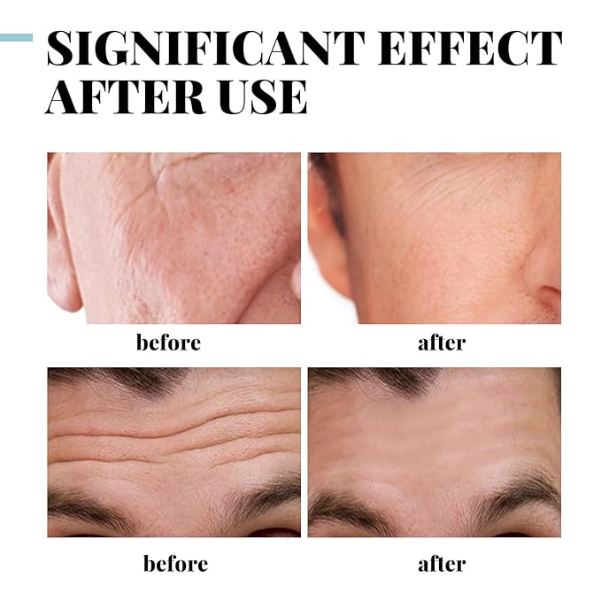 Retinol Face Cream for Men with Vitamin E & Hyaluronic Acid – Anti-Wrinkle, Deep Hydration, Firming & Moisturizing Day & Night Cream – Gentle Formula for Smooth, Youthful Skin – 1.06 oz