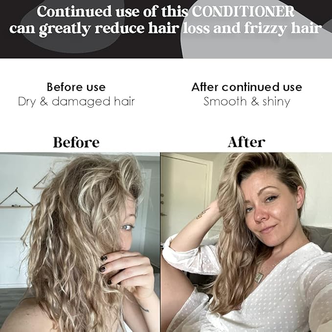 Biotin Vitamin Hair Conditioner for Thinning Hair - Moisturizing Conditioner with Aloe Vera and Cucumber Conditioning Treatment for Dry and Damaged Hair B THE PRODUCT 8.5oz