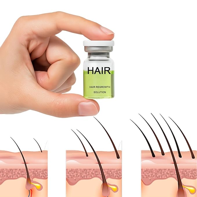 Hair Regrowth System, Advanced Hair Growth Treatment Ginseng, Eclipta Prostrata, Peppermint Oil and Ginger Root, Treatment for Thicker, Strengthens Roots,for Men and Women 1pcs