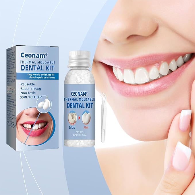 Tooth Repair Kit - Teeth Replacement Kit for Temporary Restoration of Missing & Broken Teeth Replacement Dentures, DIY Heat Fit Beads