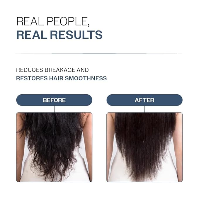 Anti-Hair Fall Conditioner with Redensyl, Rosemary & Peptides | Reduces Thinning & Breakage | Strengthens Strands, Controls Frizz & Adds Shine | For All Types | 175 g