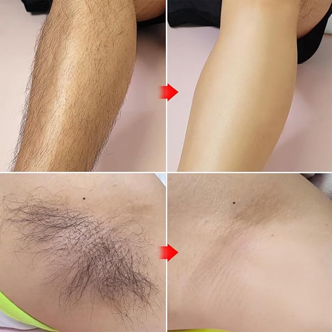 Touch-Up Painless Hair Removal Gel for Bikini Area - All Skin Types Treatment for Women & Men, 150ml