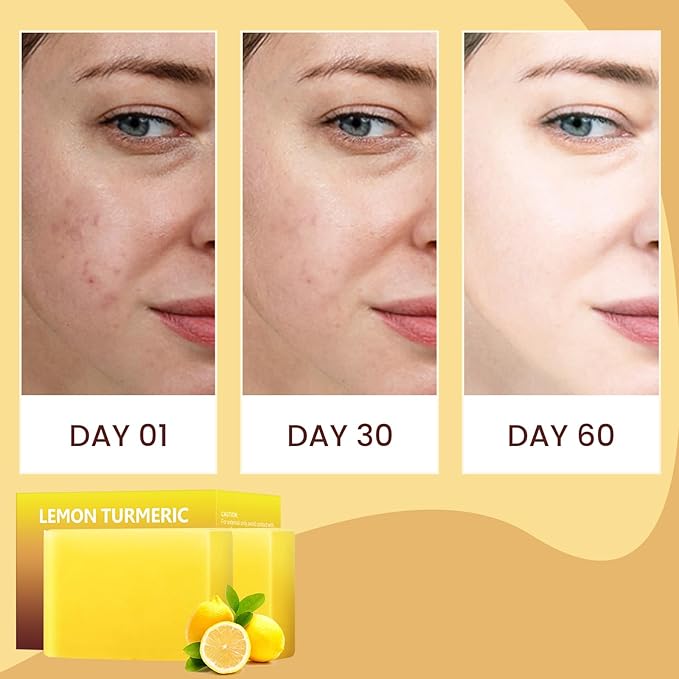 Lemon Turmeric Kojic Acid Soap Bar, Turmeric Soap for Face Body Hands, Deep Cleansing Natural Curcuma Bath Soaps Bar, Moisturizing Facial Cleanser Body Wash for All Skin Types Blemish 2 Bars