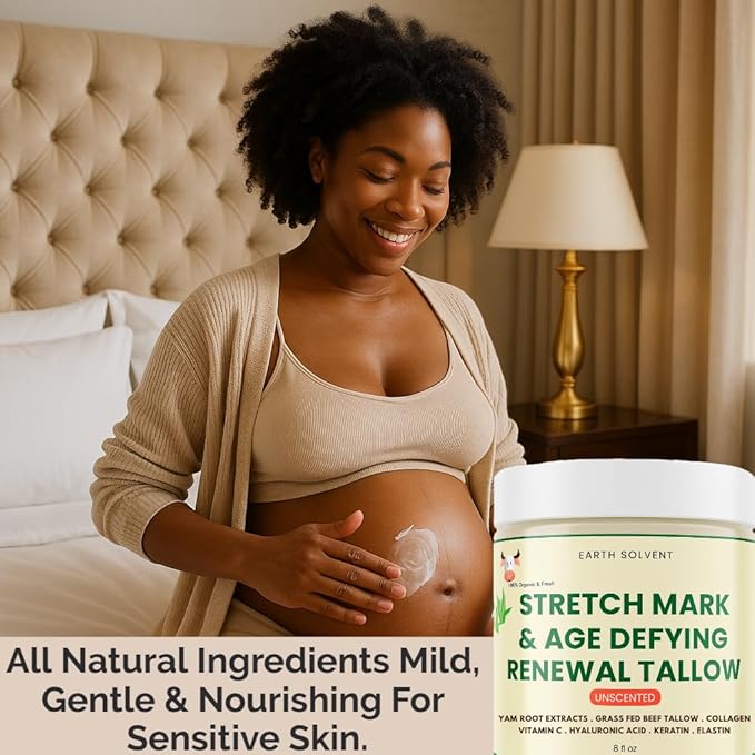 Grass Fed Beef Tallow Body Cream, Whipped Tallow Cream Hydrating Moisturizer for Sensitive Skin, Anti-aging Stretch Mark Cream For Men & Women 8 Fl Oz (8 fl oz, Lavender)