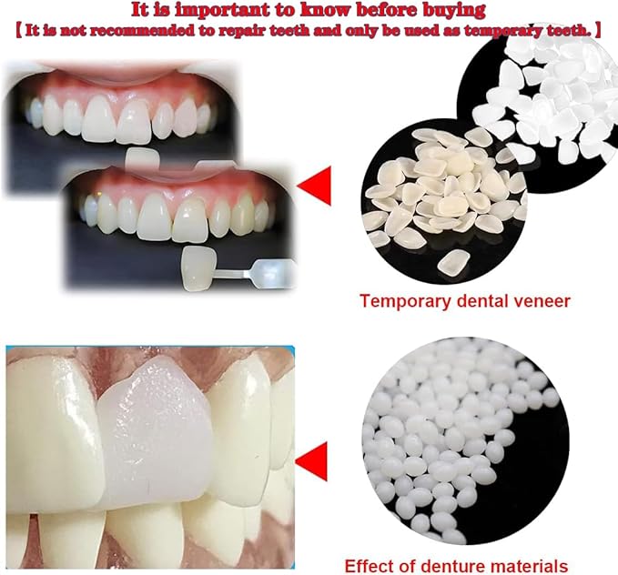 Temporary Tooth Repair Kit-Thermal Fitting Beads Granules and Fake Teeth for Temporary Moldable Fake Teeth and Thermal Beads Replacement Kit.【Teeth - Piece Yellow + White】 80Pcs