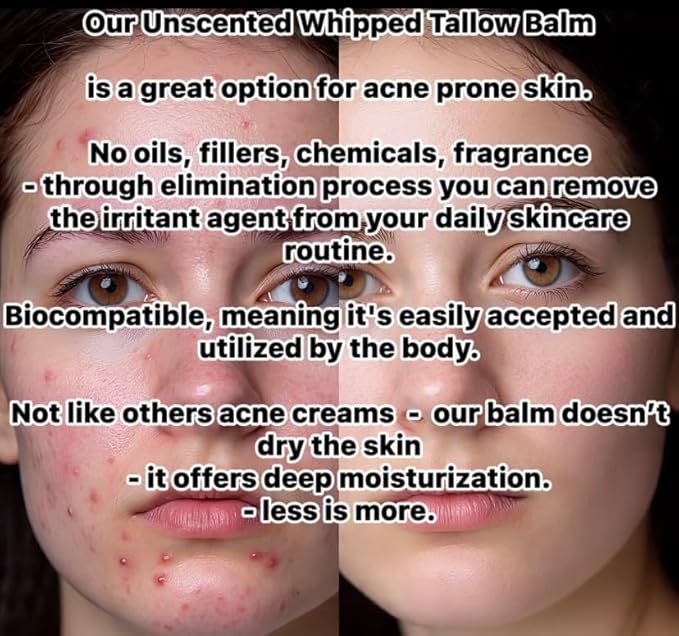 HANDMADE WHIPPED STRAWBERRY TALLOW BALM - Grass Fed - O. Essential Oils, O. Jojoba Oil, O. Arrowroot Powder