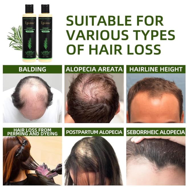 Organic Rosemary Hair Growth Shampoo for Women and Men-Natural Thickening & Strengthening Shampoo with Hydrolyzed Keratin for Thinning Hair & Hair Loss 7.4 fl.oz - 2 Packs