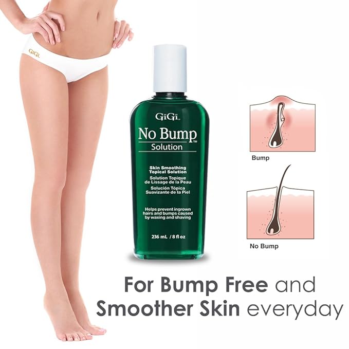 GIGI No Bump Solution - Ingrown Hair Treatment & Skin Smoothing for After Shave Waxing, Prevents Razor Bumps & Post-Waxing Irritation, 8 fl oz