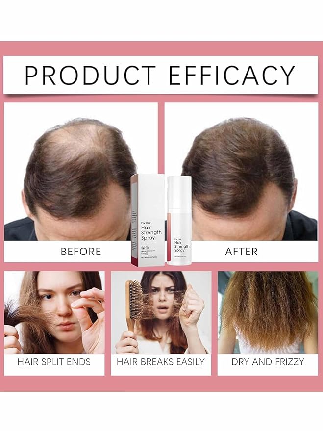 Advanced Hair Growth Oil Spray, Non-Greasy Natural Stronger and Hair Thickening Spray, Ideal for Dry Scalp - For Hair (3 Pcs)