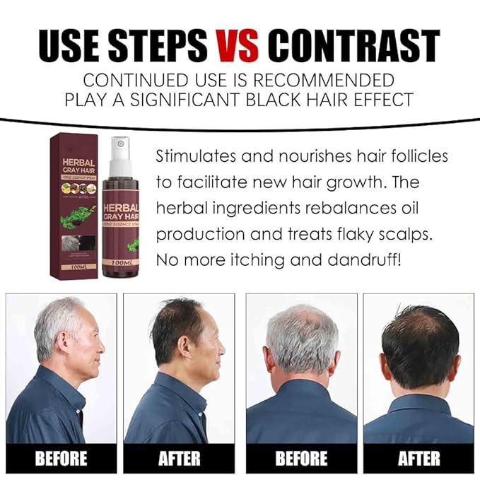 2PCS Hair Darkening Spray Anti White Hair Herbal Serum Blacken Hair Reduce Gray Scalp Nourish Glitter Scalp Spray