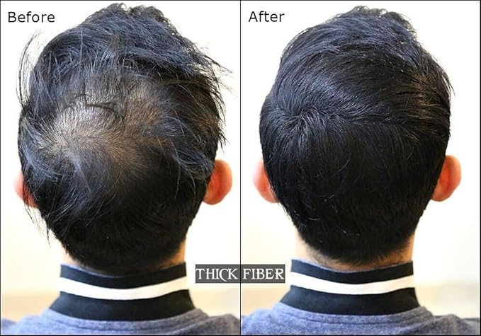 Hair Building Fibers, 28g - for Thinning Hair Instantly Thicker, Complete Looking Hair 6 Shades for Men Women (Light Blond)