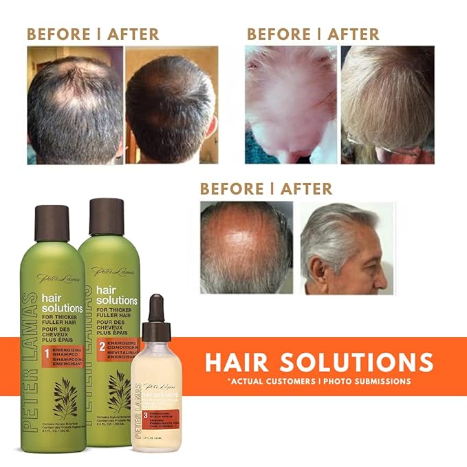 Peter Lamas Hair Solutions Scalp Energizing Hair Growth Conditioner - Biotin, Vitamin B, Trichogen, Baicapil, Aloe & Botanicals for Thicker, Fuller Hair, Anti-thinning, Reduced Flaking and DHT Buildup