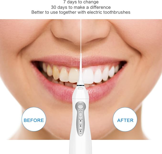 TOVENDOR Electric Water Dental Flosser Teeth Pick, Cordless Flossers Oral Irrigator IPX7 Waterproof 300ML Rechargeable Travel Water Teeth Cleaner with 5 Tips for Home Braces Care Gums Deep Cleaning