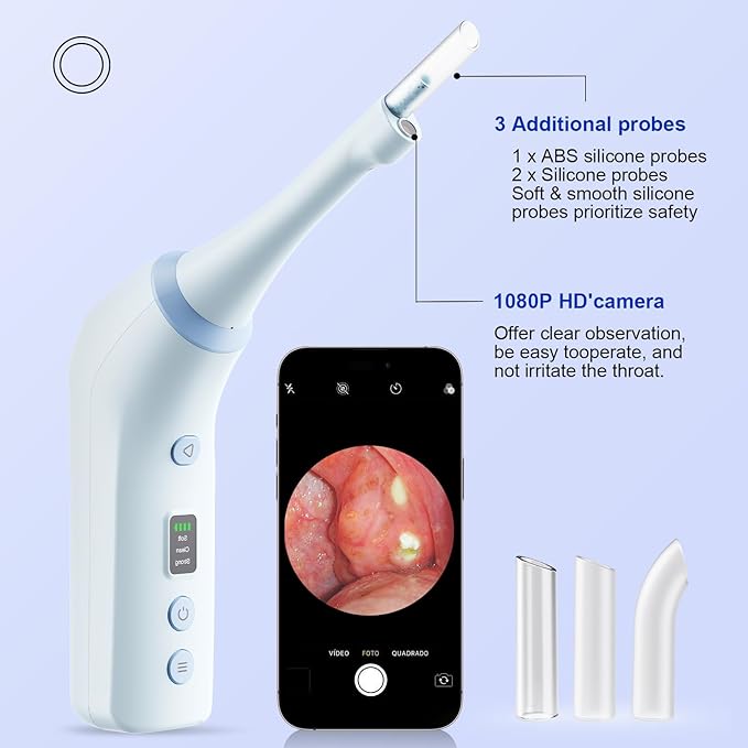 Electronic Tonsil Stone Remover with Camera, Tonsil Stone Removal Kit, 3 Suction Levels, Tonsil Stone Vacuum, Oral Care for Mouth Health, USB Rechargeable(Blue)