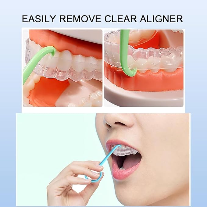 5PCS Aligner Removal Tool, Clear Aligner Remover Tools for Invisalign Removable Retainers, Aligners,Braces Removal Kit (5PCS Cyan)