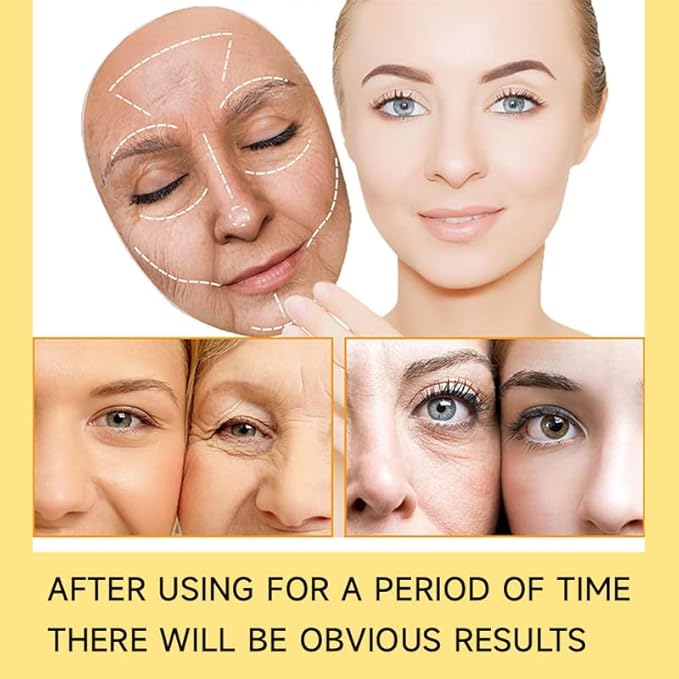 Organic Turmeric Cream, Brightening and Anti-Acne Facial Moisturizer, Skin Repair Treatment