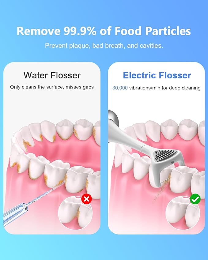 Rechargeable Electric Flosser – 4-Speed Dental Flosser with 60 Heads & Tongue Cleaner – contactless Charging Base for Adults & Kids – Dentist-Approved Gum Care & Water Flosser Alternative