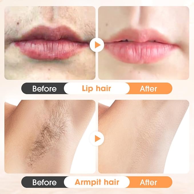 Hair Removal Cream for Women,2025 New Gentle Facial Hair Removal Cream With Scraper, Painless Hairs Removers for Body Face Lips (3)