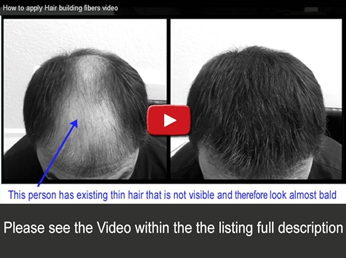 for Thinning Hair - 100% Undetectable Natural Formula - Completely Conceals Hair Loss in Seconds. Covers bald spots. Thicken your hair instantly - 25 Grams Refill (DARK GRAY)