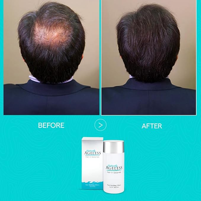 Instantly Ageless® Hair in Seconds™ Hair Building Fibers – Hair Thickening Fibers for Thinning Hair & Hair Loss for Fuller-Look - 0.83 oz (23g) - Medium Brown