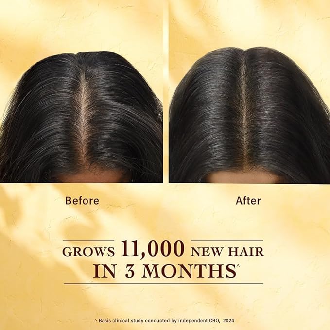 LifewithQueenP Hair Growth Oil, 30ml | Ayurvedic Hair Growth Serum, Quick-Absorbing, Strengthens Roots – Leaves Hair Black & Shiny, Reduces Split Ends & Dryness (2pc)