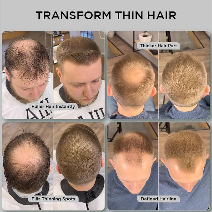 THICK FIBER Hair Fibers for Thinning Hair & Bald spots (LIGHT BROWN) - 25g Bottle - Conceals Hair Loss in Seconds - Hair Powder for Women & Men