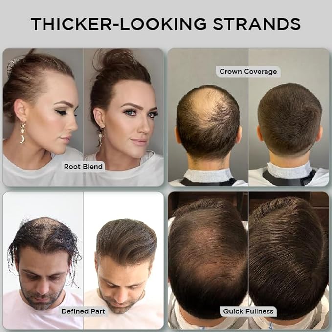 THICK FIBER Hair Fibers for Thinning Hair & Bald spots (DARK BROWN, Pack of 2) - 25g Bottle - Conceals Hair Loss in Seconds - Hair Powder For Women & Men