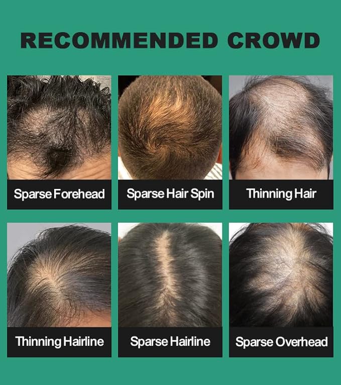 DARK BLONDE Hair Fibers for Thinning Hair 27.5g Bottle with Applicator | Natural Keratin Hair Fibers Concealer for Hair Loss for Men and Women | Hair Building Fibres Powder [DARK BLONDE]